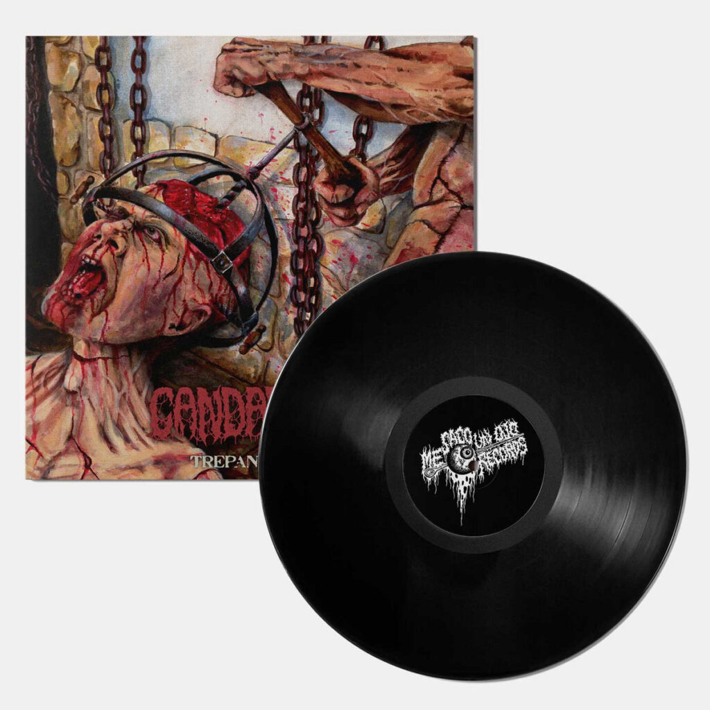 CANDARIAN – Trepanación